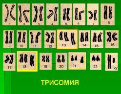 Фото с изображением трисомии хромосом